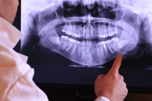 Best Emergency Dentist for Knocked-Out Tooth in Boswell, PA